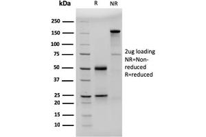 anti-Fc Fragment of IgE, Low Affinity II, Receptor For (CD23) (FCER2) (AA 48-321) antibody