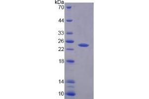 Image no. 1 for Protein tyrosine Phosphatase, Receptor Type, N Polypeptide 2 (PTPRN2) (AA 839-1015) protein (His tag) (ABIN6239396)