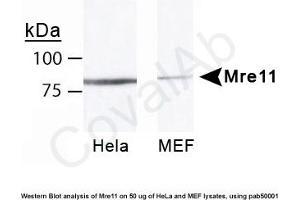 Image no. 5 for anti-MRE11 Meiotic Recombination 11 Homolog A (S. Cerevisiae) (MRE11A) antibody (ABIN363310)