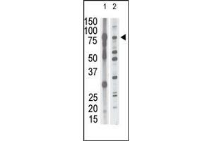 anti-Matrix Metallopeptidase 15 (Membrane-inserted) (MMP15) (AA 165-194), (N-Term) antibody