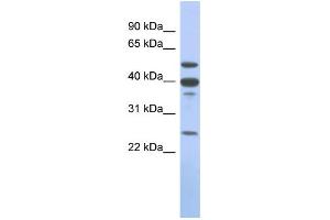 Image no. 1 for anti-Matrix Metallopeptidase 13 (Collagenase 3) (MMP13) (Middle Region) antibody (ABIN2786656)