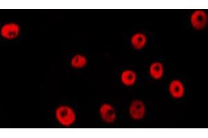 Image no. 2 for anti-Ring Finger Protein 20 (RNF20) antibody (ABIN6264788)