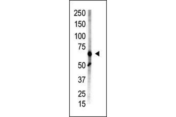 anti-Zinc Finger, MIZ-Type Containing 1 (ZMIZ1) (AA 1038-1067), (C-Term) antibody