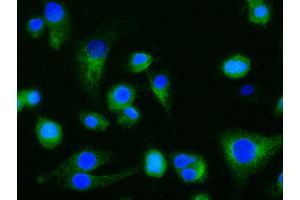Image no. 1 for anti-C-Type Lectin Domain Family 7, Member A (CLEC7A) (AA 69-244) antibody (ABIN2691803)