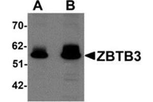 Image no. 1 for anti-Zinc Finger and BTB Domain Containing 3 (ZBTB3) (C-Term) antibody (ABIN783353)