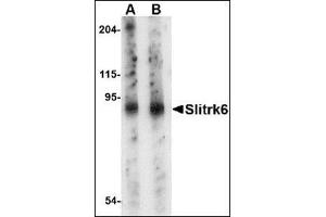 Image no. 2 for anti-SLIT and NTRK-Like Family, Member 6 (SLITRK6) (Center) antibody (ABIN500772)
