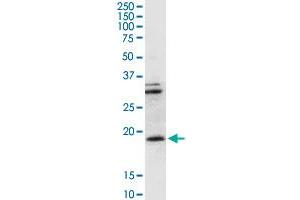 anti-CD247 Molecule (CD247) (AA 1-164) antibody