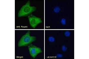 Image no. 4 for anti-PYD and CARD Domain Containing (PYCARD) (Internal Region) antibody (ABIN1590015)