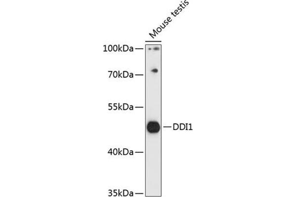 DDI1 anticorps  (AA 97-396)