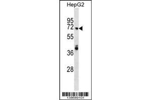 Image no. 1 for anti-rho GTPase Activating Protein 40 (ARHGAP40) (AA 91-117), (N-Term) antibody (ABIN1539648)