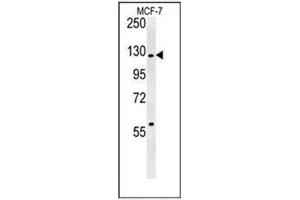 Image no. 2 for anti-RAB GTPase Activating Protein 1 (RABGAP1) (AA 21-51), (N-Term) antibody (ABIN954422)