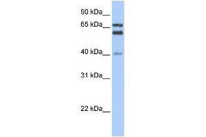Image no. 1 for anti-Glutamate-Cysteine Ligase, Catalytic Subunit (GCLC) (N-Term) antibody (ABIN2774078)