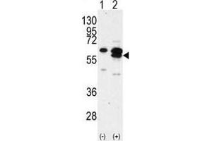 Image no. 3 for anti-Calcium/calmodulin-Dependent Protein Kinase IG (CAMK1G) (C-Term) antibody (ABIN359470)