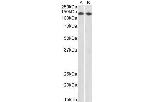 Image no. 1 for anti-Cell Cycle and Apoptosis Regulator 2 (CCAR2) (AA 842-855) antibody (ABIN5539937)