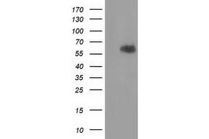 Image no. 2 for anti-Exonuclease 3'-5' Domain Containing 1 (EXD1) antibody (ABIN2720605)