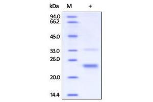 Image no. 1 for CD160 (CD160) (AA 27-159) (Active) protein (His tag) (ABIN2444058)
