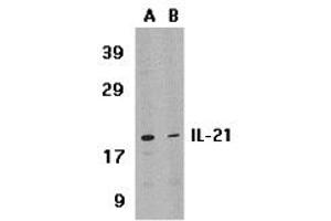Image no. 1 for anti-Interleukin 21 (IL21) (Middle Region) antibody (ABIN1030955)