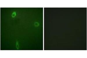 Immunofluorescence analysis of A549 cells, using ROMK/Kir1.