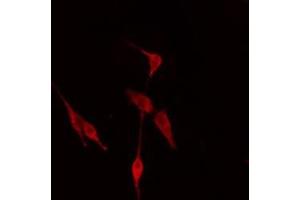 Image no. 4 for anti-TNFRSF1A-Associated Via Death Domain (TRADD) (N-Term) antibody (ABIN6265701)