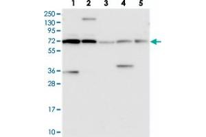 Image no. 2 for anti-Protein Disulfide Isomerase-Like, Testis Expressed (PDILT) antibody (ABIN5585441)