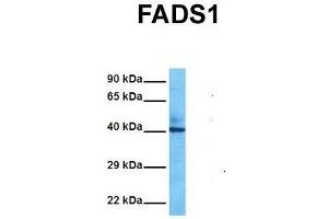 Image no. 2 for anti-Fatty Acid Desaturase 1 (FADS1) (C-Term) antibody (ABIN2775387)
