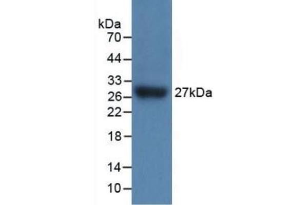 IL17RC 抗体  (AA 73-330)