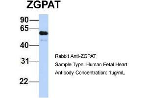 Image no. 2 for anti-Zinc Finger, CCCH-Type with G Patch Domain (ZGPAT) (Middle Region) antibody (ABIN2775555)