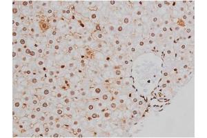 Image no. 4 for anti-Mast/stem Cell Growth Factor Receptor (KIT) (pTyr721) antibody (ABIN6256004)