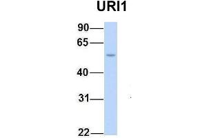 Image no. 6 for anti-URI1, Prefoldin-Like Chaperone (URI1) (Middle Region) antibody (ABIN2784320)