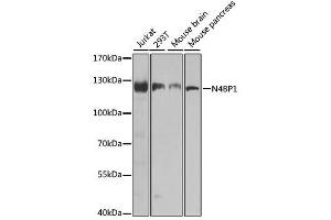 Image no. 2 for anti-NEDD4 Binding Protein 1 (N4BP1) antibody (ABIN6144311)