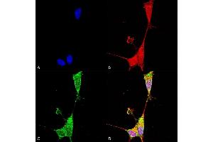 Immunocytochemistry/Immunofluorescence analysis using Mouse Anti-Brevican Monoclonal Antibody, Clone S294A-6 (ABIN1686637).