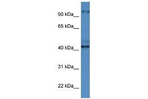 Image no. 1 for anti-Ataxia, Cerebellar, Cayman Type (ATCAY) (C-Term) antibody (ABIN926621)