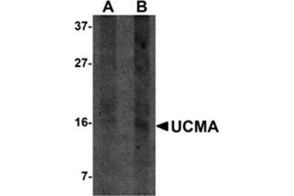 anti-Upper Zone of Growth Plate and Cartilage Matrix Associated (UCMA) (C-Term) antibody
