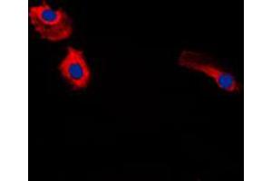 Image no. 1 for anti-Gastrin (GAST) (Center) antibody (ABIN2706210)