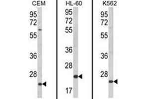 Image no. 1 for anti-Killer Cell Lectin-Like Receptor Subfamily C, Member 2 (KLRC2) (N-Term) antibody (ABIN453719)
