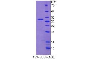 Image no. 1 for Core-Binding Factor, beta Subunit (CBFB) (AA 1-187) protein (T7 tag,His tag) (ABIN6238823)