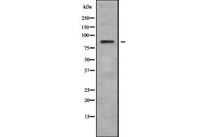 Image no. 2 for anti-Leucine Rich Repeat and Sterile alpha Motif Containing 1 (LRSAM1) antibody (ABIN6263013)