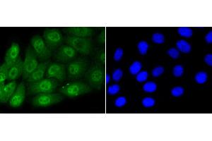 Image no. 2 for anti-SMAD, Mothers Against DPP Homolog 5 (SMAD5) (pSer463), (pSer465) antibody (ABIN5557527)