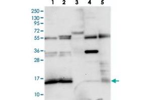 Image no. 1 for anti-Family with Sequence Similarity 103, Member A1 (FAM103A1) antibody (ABIN5577714)