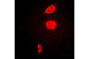 Image no. 2 for anti-Activating Transcription Factor 1 (AFT1) (C-Term) antibody (ABIN2704505)