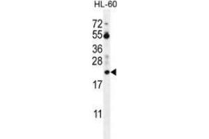Image no. 2 for anti-Prothymosin, alpha (PTMA) (AA 8-39), (N-Term) antibody (ABIN954324)