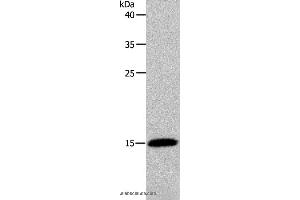 Image no. 3 for anti-Profilin 2 (PFN2) antibody (ABIN2426357)