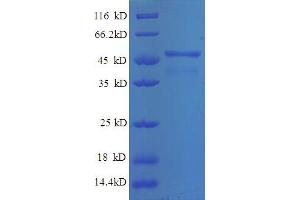 Image no. 1 for Breast Cancer Metastasis Suppressor 1 (BRMS1) (AA 1-235), (partial) protein (GST tag) (ABIN5712363)