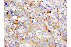 Image no. 1 for anti-Platelet Factor 4 (PF4) (AA 85-101), (C-Term) antibody (ABIN3043213)