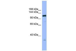 Image no. 1 for anti-HAUS Augmin-Like Complex, Subunit 6 (HAUS6) (Middle Region) antibody (ABIN632011)