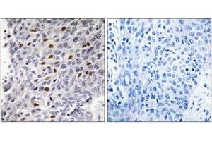 Image no. 2 for anti-Activating Transcription Factor 1 (AFT1) (AA 31-80) antibody (ABIN1532278)