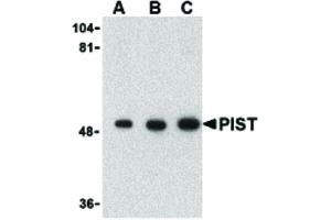 Image no. 1 for anti-Golgi-Associated PDZ and Coiled-Coil Motif Containing (GOPC) (C-Term) antibody (ABIN6657012)