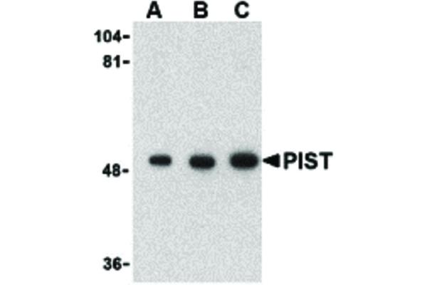 anti-Golgi-Associated PDZ and Coiled-Coil Motif Containing (GOPC) (C-Term) antibody