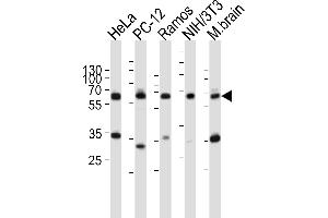 Image no. 4 for anti-Pyruvate Kinase M2 (PKM2) (AA 476-505), (C-Term) antibody (ABIN391053)
