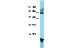 Image no. 4 for anti-GLI Family Zinc Finger 2 (GLI2) (Middle Region) antibody (ABIN2777474)